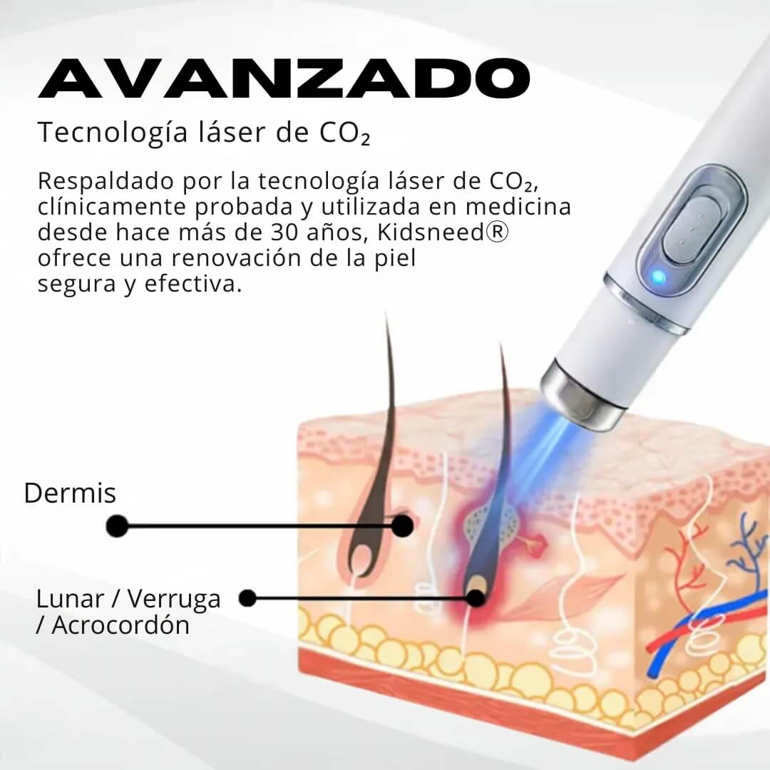 Kidsneed® – Bolígrafo láser para quitar lunares y verrugas
